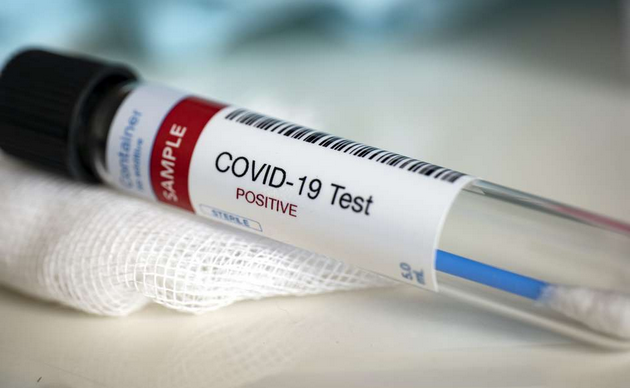 Covid-19 : le manque de test de dépistage fait planer des doutes